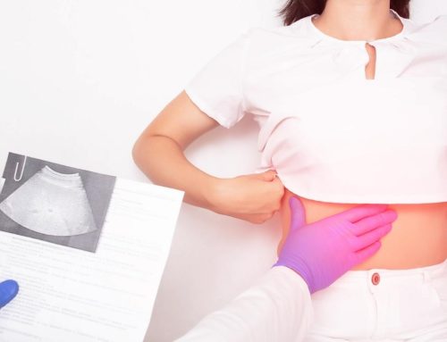 Masna jetra! Najbolja dijeta za masnu jetru!