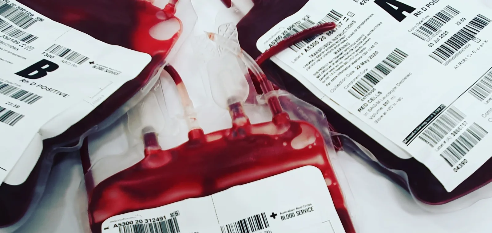 Sanjarica krvi - Različita značenja i simbolika snova o krvi