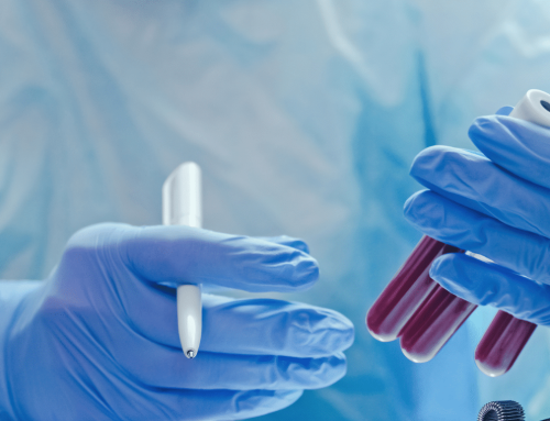 Povišene Masnoće u Krvi: Prirodna Podrška uz Aloe Vera Gel i Arctic Sea