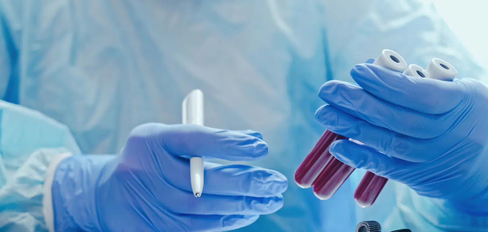 Povišene Masnoće u Krvi: Prirodna Podrška uz Aloe Vera Gel i Arctic Sea